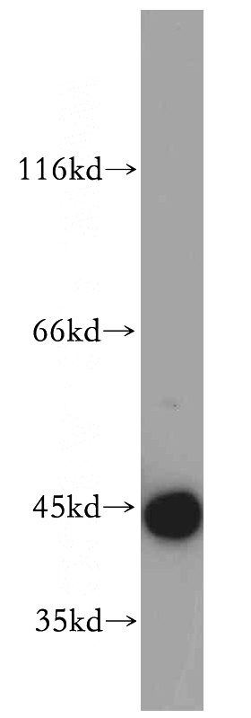 HeLa cells were subjected to SDS PAGE followed by western blot with Catalog No:108978(CCDC51 antibody) at dilution of 1:500