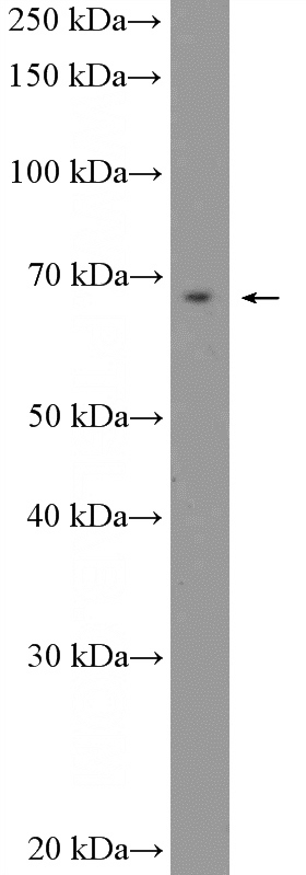 HEK-293 cells were subjected to SDS PAGE followed by western blot with Catalog No:113195(SLC12A1 Antibody) at dilution of 1:600
