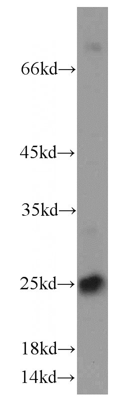 human placenta tissue were subjected to SDS PAGE followed by western blot with Catalog No:109147(CD9 antibody) at dilution of 1:500