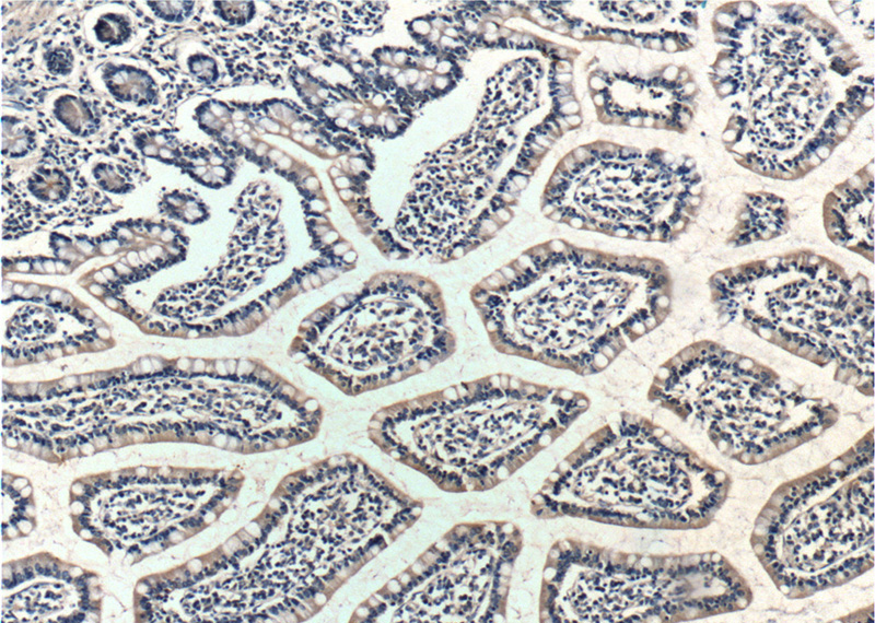Immunohistochemistry of paraffin-embedded human small intestine tissue slide using Catalog No:114533(RAMP1 Antibody) at dilution of 1:200 (under 10x lens).
