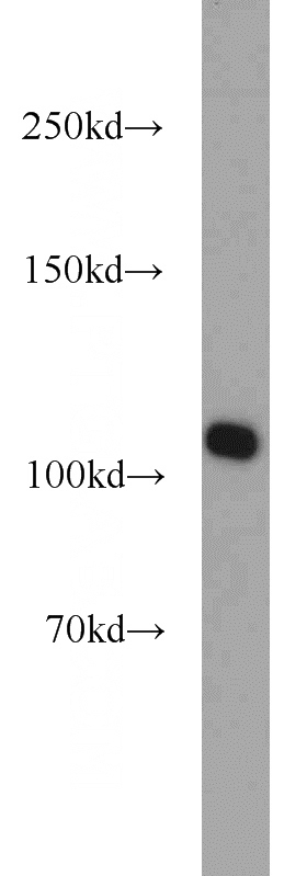 HEK-293 cells were subjected to SDS PAGE followed by western blot with Catalog No:114599(RBM15 antibody) at dilution of 1:1000