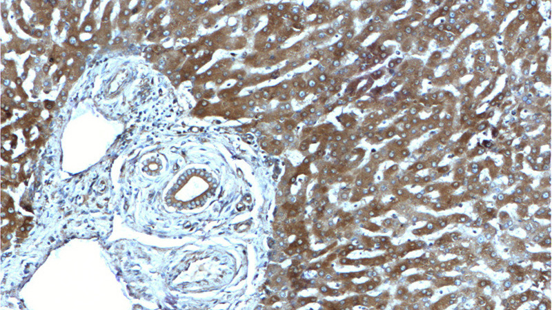 Immunohistochemistry of paraffin-embedded human liver tissue slide using Catalog No:110764(G6PC Antibody) at dilution of 1:200 (under 10x lens).