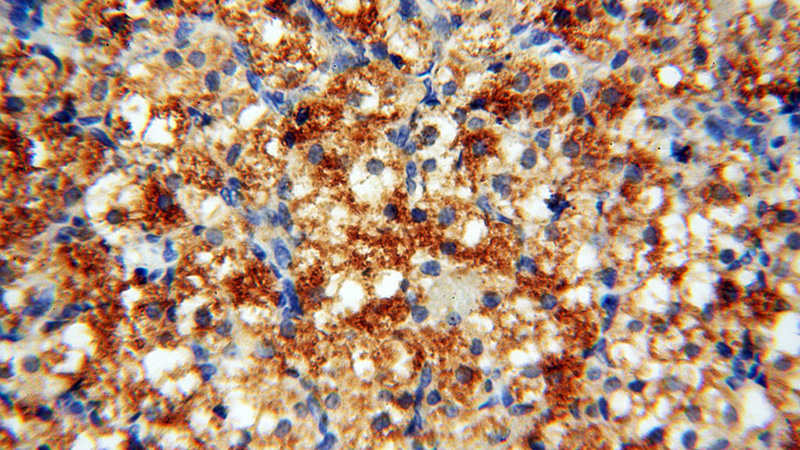 Immunohistochemical of paraffin-embedded human ovary using Catalog No:109488(PTGS2 antibody) at dilution of 1:50 (under 40x lens)