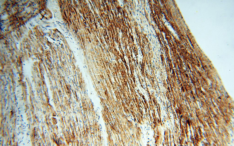 Immunohistochemical of paraffin-embedded human heart using Catalog No:113678(PDHA1 antibody) at dilution of 1:100 (under 10x lens)