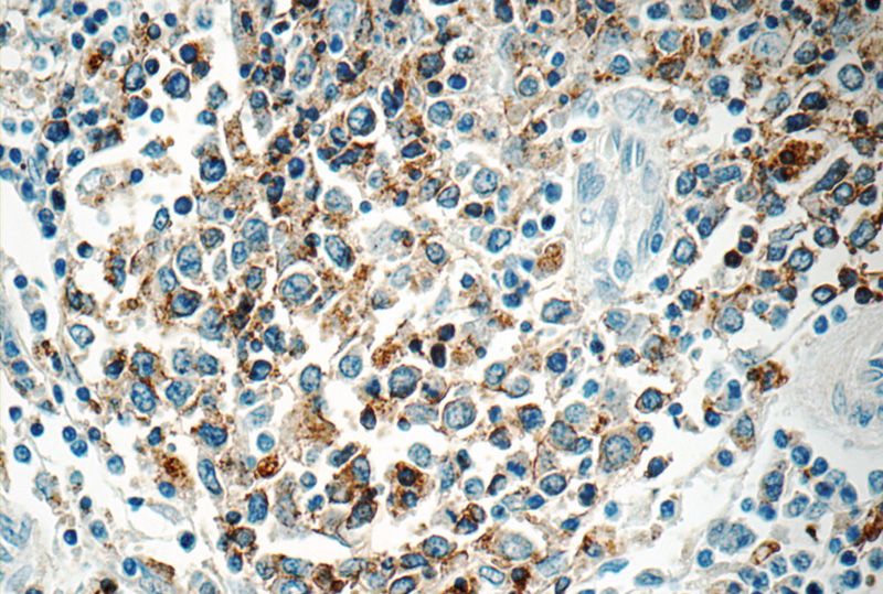 Immunohistochemistry of paraffin-embedded human spleen tissue slide using Catalog No:111421(HLA-DPB1 Antibody) at dilution of 1:50 (under 40x lens)