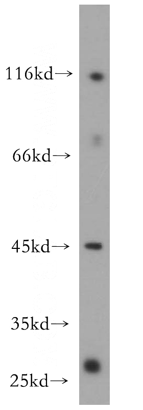 BxPC-3 cells were subjected to SDS PAGE followed by western blot with Catalog No:115883(TBRG1 antibody) at dilution of 1:600
