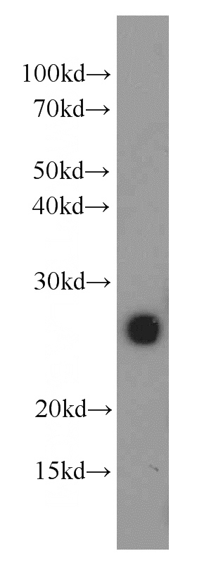 mouse brain tissue were subjected to SDS PAGE followed by western blot with Catalog No:112728(MOG antibody) at dilution of 1:500