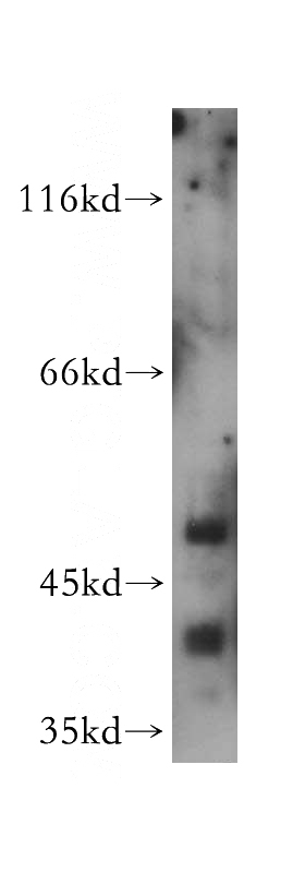 HeLa cells were subjected to SDS PAGE followed by western blot with Catalog No:114590(RBBP4 antibody) at dilution of 1:1000