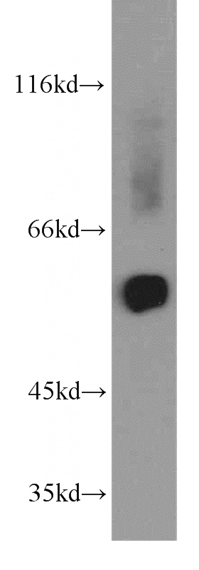 human heart tissue were subjected to SDS PAGE followed by western blot with Catalog No:111094(GMCL1 antibody) at dilution of 1:1500