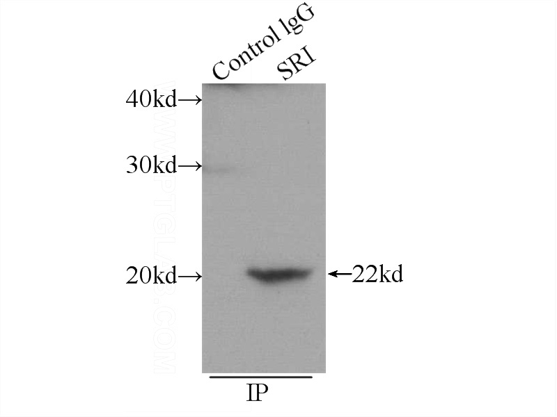 IP Result of anti-SRI (IP:Catalog No:115589, 3ug; Detection:Catalog No:115589 1:500) with HepG2 cells lysate 600ug.