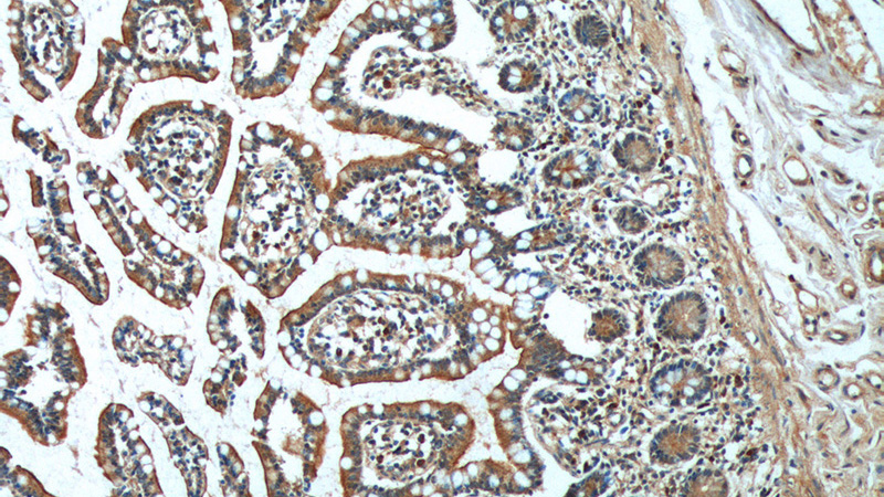 Immunohistochemistry of paraffin-embedded human small intestine tissue slide using Catalog No:111109(GPR128 Antibody) at dilution of 1:100 (under 10x lens).