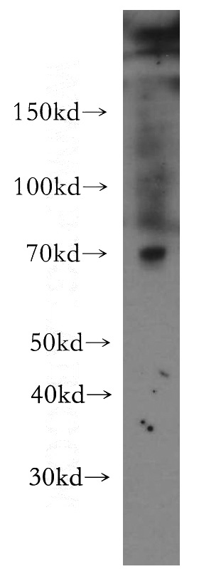 mouse skeletal muscle tissue were subjected to SDS PAGE followed by western blot with Catalog No:115309(SLC1A4 antibody) at dilution of 1:500