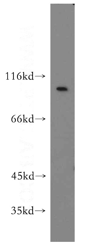 A549 cells were subjected to SDS PAGE followed by western blot with Catalog No:111866(ITGB6-Specific antibody) at dilution of 1:500
