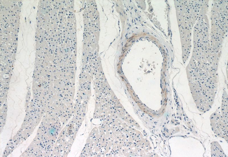 Immunohistochemical of paraffin-embedded human heart using Catalog No:116864(WDR37 antibody) at dilution of 1:50 (under 10x lens)