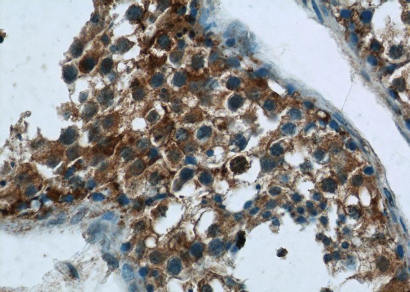 Immunohistochemistry of paraffin-embedded human testis tissue slide using Catalog No:112329(LRRC18 Antibody) at dilution of 1:50 (under 40x lens)