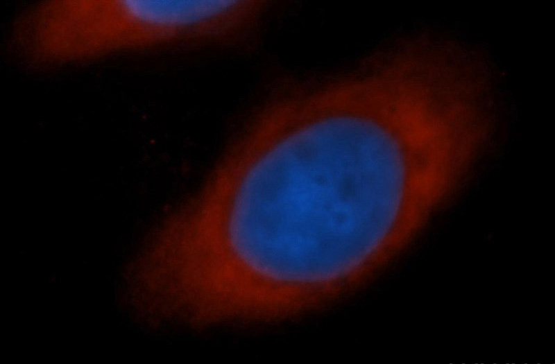 Immunofluorescent analysis of MCF-7 cells, using EIF5B antibody Catalog No:110269 at 1:50 dilution and Rhodamine-labeled goat anti-rabbit IgG (red). Blue pseudocolor = DAPI (fluorescent DNA dye).