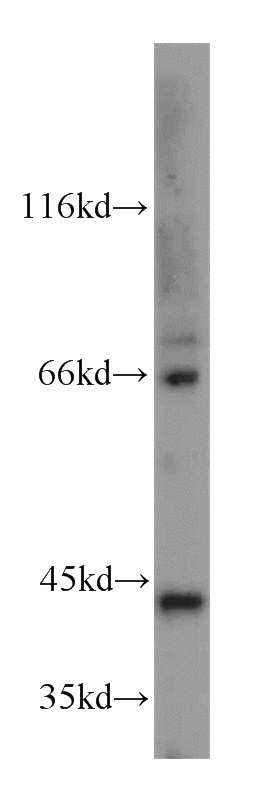 mouse lung tissue were subjected to SDS PAGE followed by western blot with Catalog No:111105(GNA14 antibody) at dilution of 1:600