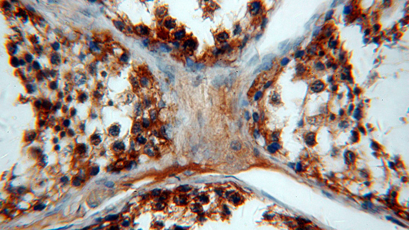 Immunohistochemical of paraffin-embedded human testis using Catalog No:116854(WDR1 antibody) at dilution of 1:100 (under 40x lens)