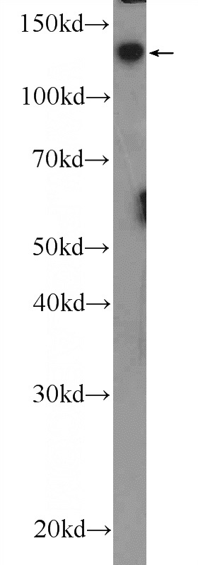 Jurkat cells were subjected to SDS PAGE followed by western blot with Catalog No:111100(GMIP Antibody) at dilution of 1:600