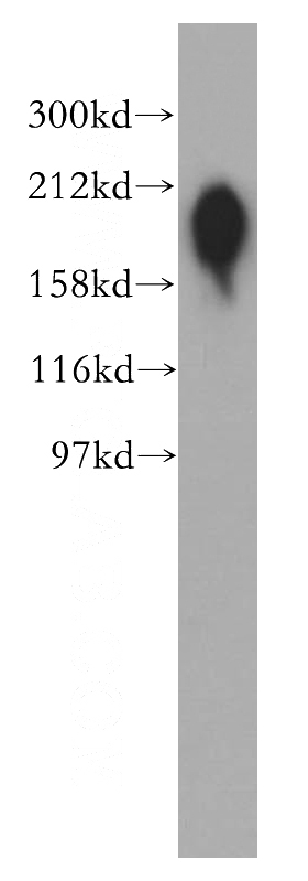 A549 cells were subjected to SDS PAGE followed by western blot with Catalog No:113194(SLC12A2 antibody) at dilution of 1:400