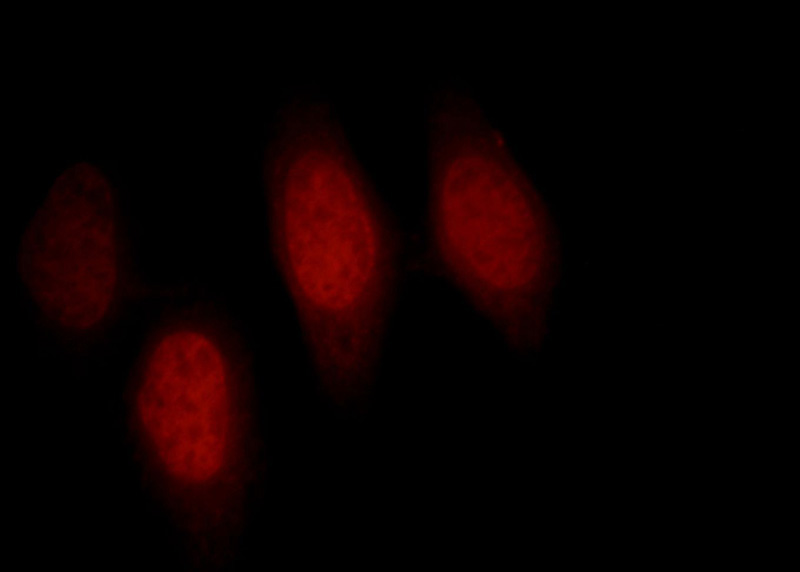 Immunofluorescent analysis of HepG2 cells, using SMARCC2 antibody Catalog No:108405 at 1:25 dilution and Rhodamine-labeled goat anti-rabbit IgG (red).