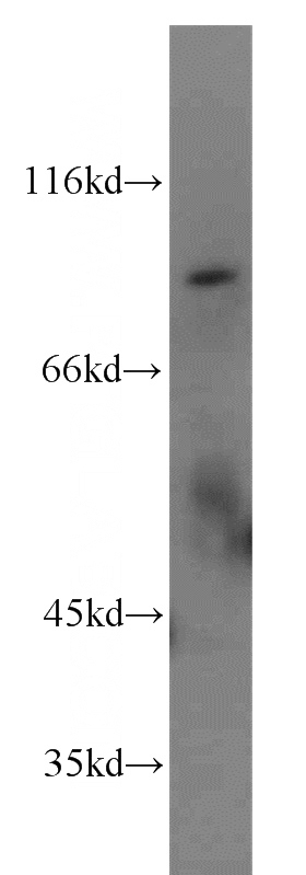 mouse lung tissue were subjected to SDS PAGE followed by western blot with Catalog No:114633(RFWD3 antibody) at dilution of 1:1000
