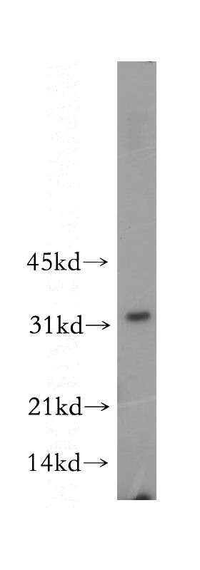 HepG2 cells were subjected to SDS PAGE followed by western blot with Catalog No:107945(AKR7A2 antibody) at dilution of 1:200