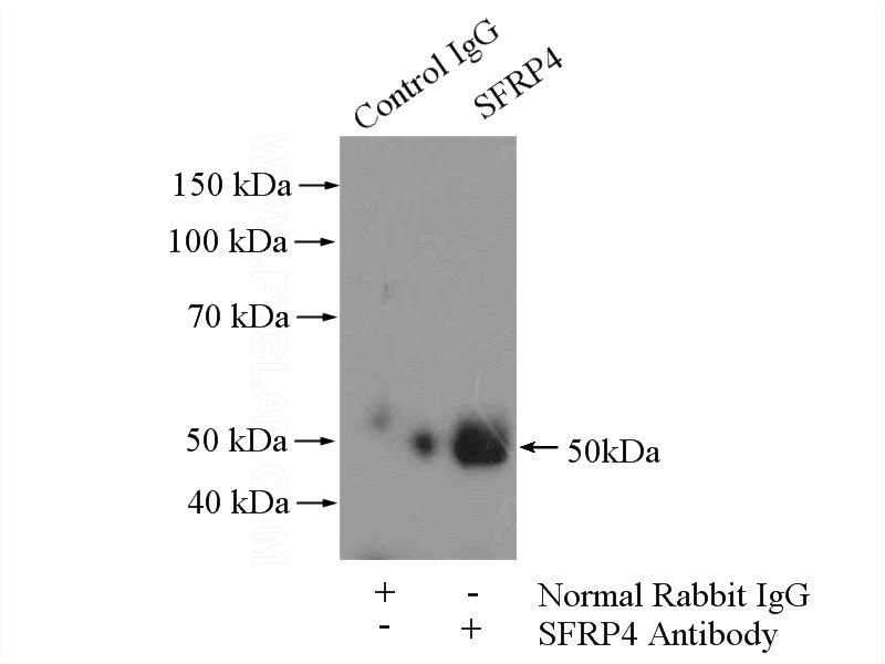 IP Result of anti-SFRP4 (IP:Catalog No:115146, 4ug; Detection:Catalog No:115146 1:500) with HeLa cells lysate 2000ug.