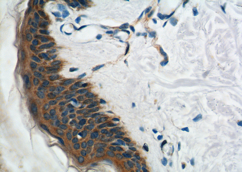 Immunohistochemistry of paraffin-embedded human skin tissue slide using Catalog No:113938(PKP3 Antibody) at dilution of 1:200 (under 40x lens).