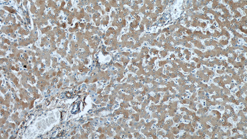 Immunohistochemical of paraffin-embedded human liver using Catalog No:107959(ALDH1A1 antibody) at dilution of 1:50 (under 10x lens)