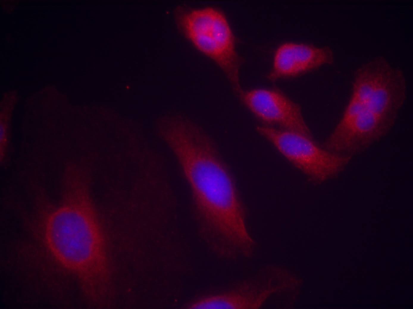 Immunofluorescence staining of methanol-fixed Hela cells using NF-κB p65 (Phospho-Ser536) Antibody .
