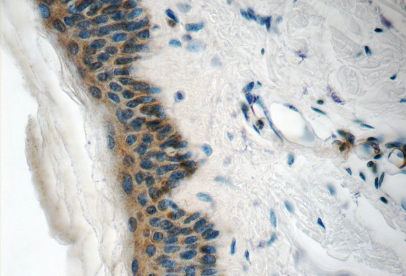 Immunohistochemistry of paraffin-embedded human skin tissue slide using Catalog No:108706(C21orf58 Antibody) at dilution of 1:50 (under 40x lens)