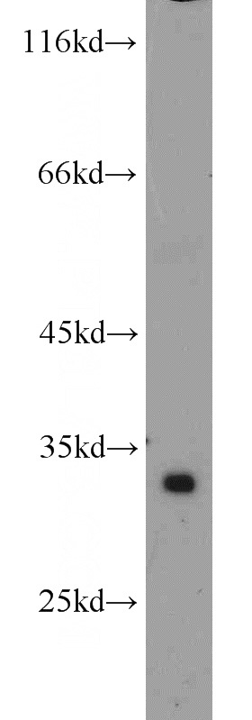 human skeletal muscle tissue were subjected to SDS PAGE followed by western blot with Catalog No:108351(ATP5C1 antibody) at dilution of 1:500