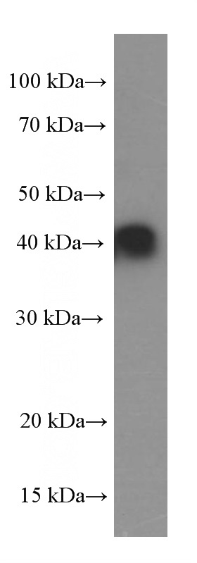 fetal human brain tissue were subjected to SDS PAGE followed by western blot with Catalog No:107307(GSNOR,ADH5 Antibody) at dilution of 1:4000