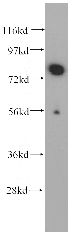 Jurkat cells were subjected to SDS PAGE followed by western blot with Catalog No:116869(WDR46 antibody) at dilution of 1:400