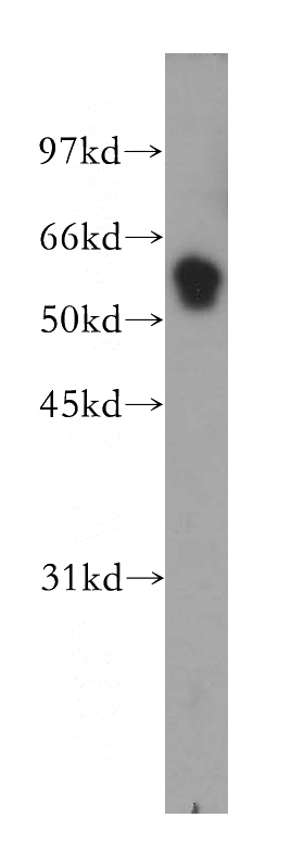 human liver tissue were subjected to SDS PAGE followed by western blot with Catalog No:116314(TRIM38 antibody) at dilution of 1:800
