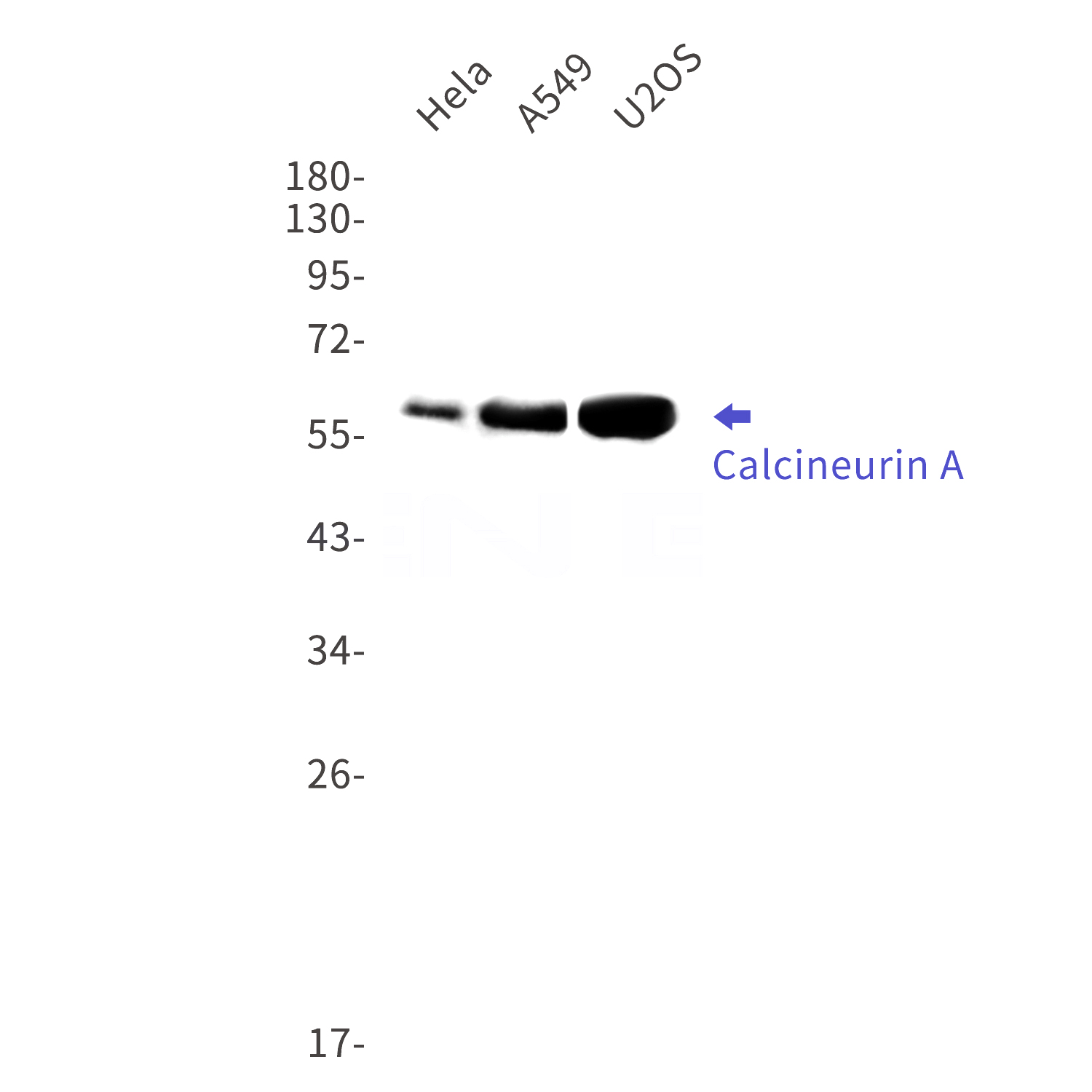 Western blot detection of Calcineurin A in Hela,A549,U2OS cell lysates using Calcineurin A Rabbit mAb(1:1000 diluted).Predicted band size:59kDa.Observed band size:59kDa.