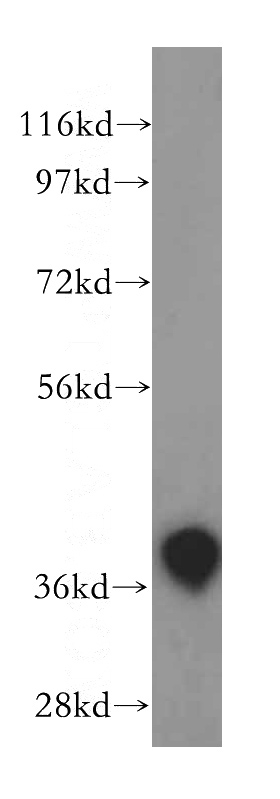 human brain tissue were subjected to SDS PAGE followed by western blot with Catalog No:108233(ASNA1 antibody) at dilution of 1:500
