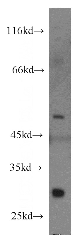 Jurkat cells were subjected to SDS PAGE followed by western blot with Catalog No:116229(TRAF1 antibody) at dilution of 1:500