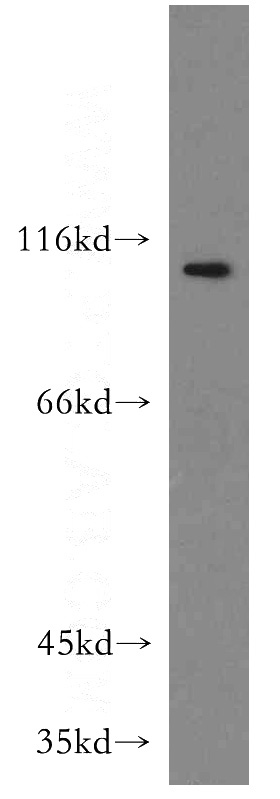 mouse heart tissue were subjected to SDS PAGE followed by western blot with Catalog No:112196(LEO1 antibody) at dilution of 1:500