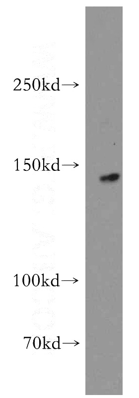 mouse heart tissue were subjected to SDS PAGE followed by western blot with Catalog No:112005(KIF1C antibody) at dilution of 1:500
