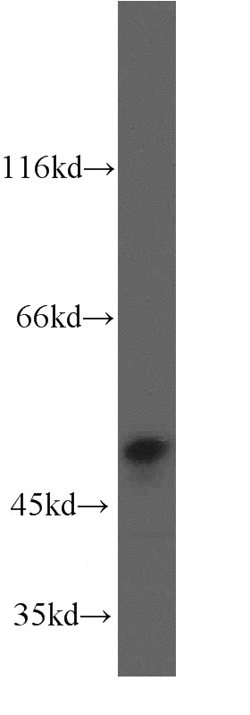 Jurkat cells were subjected to SDS PAGE followed by western blot with Catalog No:114310(PTPN1 antibody) at dilution of 1:300
