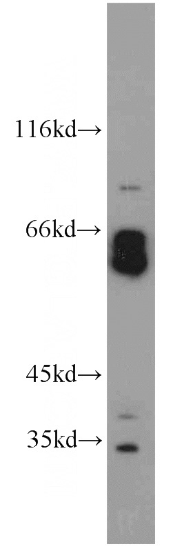 SH-SY5Y cells were subjected to SDS PAGE followed by western blot with Catalog No:109978(DISC1-long-specific antibody) at dilution of 1:200