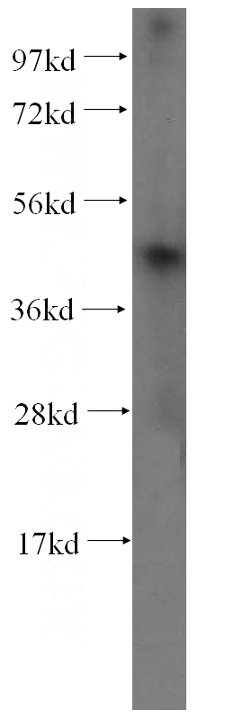 A375 cells were subjected to SDS PAGE followed by western blot with Catalog No:114578(RCL1 antibody) at dilution of 1:500