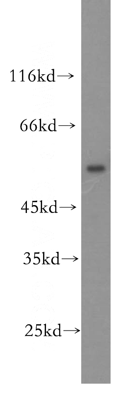 mouse thymus tissue were subjected to SDS PAGE followed by western blot with Catalog No:113471(POU2F2-Specific antibody) at dilution of 1:300