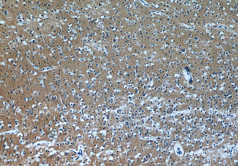 Immunohistochemistry of paraffin-embedded human brain tissue slide using Catalog No:107934(AKAP7 Antibody) at dilution of 1:50 (under 10x lens)