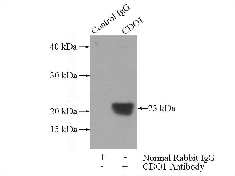 IP Result of anti-CDO1 (IP:Catalog No:109717, 3ug; Detection:Catalog No:109717 1:600) with mouse liver tissue lysate 4000ug.