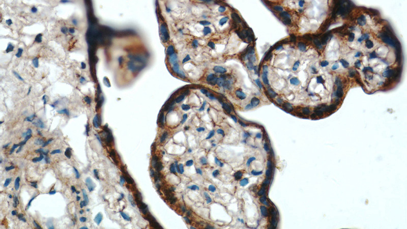 Immunohistochemistry of paraffin-embedded human placenta tissue slide using Catalog No:107143(CD71 Antibody) at dilution of 1:200 (under 40x lens)