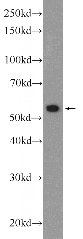 HEK-293 cells were subjected to SDS PAGE followed by western blot with Catalog No:108109(ANTXR2 Antibody) at dilution of 1:600