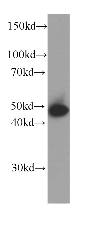 A431 cells were subjected to SDS PAGE followed by western blot with Catalog No:107230(KRT15 antibody) at dilution of 1:1000